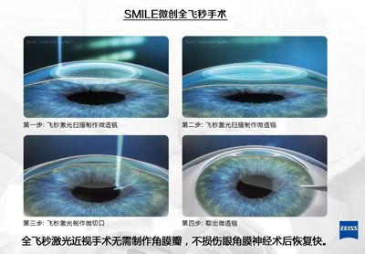 公务员视力体检标准